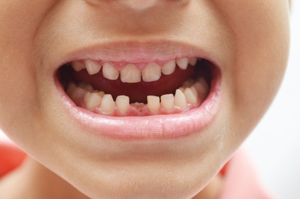 Konečně první dětské zuby se bezzubé chlapec úsměv detail - Fotografie, Obrázek