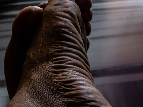 Zblízka obraz nohou člověka s vlněnou texturou pleti. - Fotografie, Obrázek
