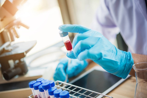 Laboratorní technik analyzuje vzorek krve ve zkumavce v laboratoři. Koncepce lékařského, farmaceutického a vědeckého výzkumu a vývoje  - Fotografie, Obrázek