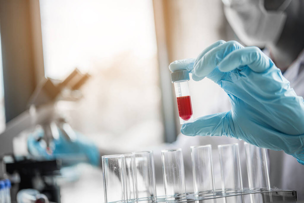 lab technician assistant analyzing a blood sample in test tube at laboratory. Medical, pharmaceutical and scientific research and development concept  - Photo, image