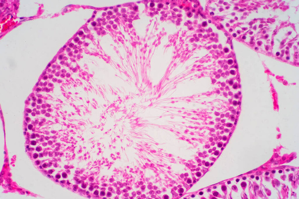 Ihmisen sperma kivesten morfologiassa mikroskoopilla. Mikrograafi osoittaa spermatozoon patologian koulutukseen. - Valokuva, kuva