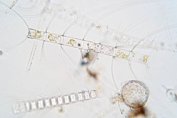 A Chaetoceros tengeri planktonikus diatomok mikroszkóp alatt.. - Fotó, kép