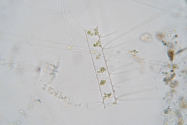 Chaetoceros é diatomáceas planctônicas marinhas sob a visão do microscópio. - Foto, Imagem