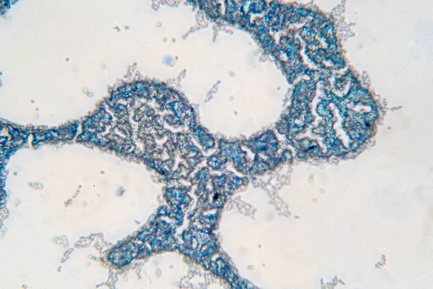 Saccharomyces cerevisiae дріжджовий бутонізатор під мікроскопом
. - Фото, зображення