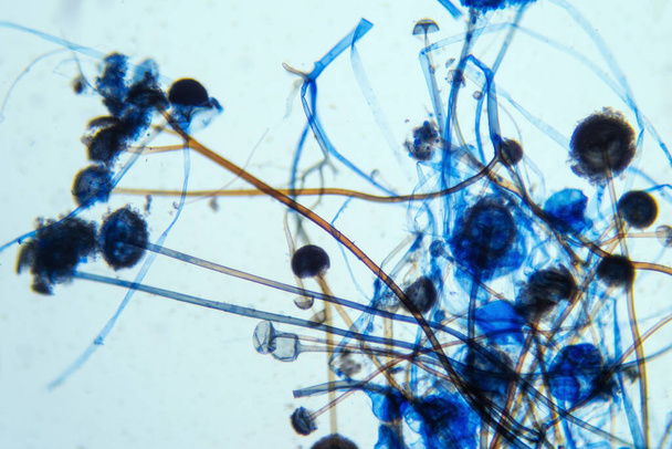 Rhizopus bread mold under the microscope. Rhizopus is a genus of common saprophytic fungi. - Photo, Image