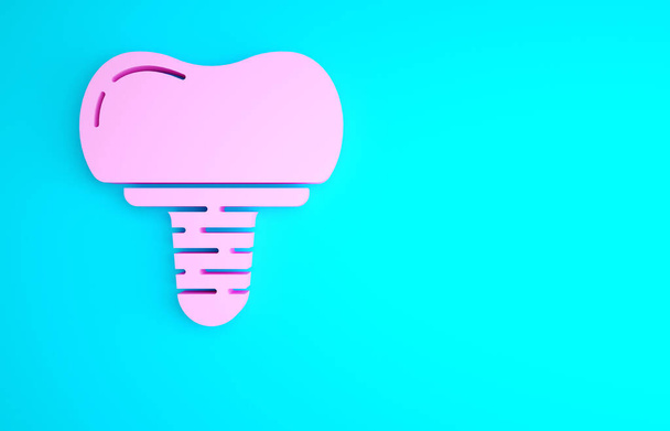 ピンクのインプラント青い背景に隔離された歯科アイコン。最小限の概念。3Dイラスト3Dレンダリング. - 写真・画像