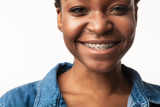 Африканская девушка с брекетами улыбается в камеру на белом фоне - Фото, изображение