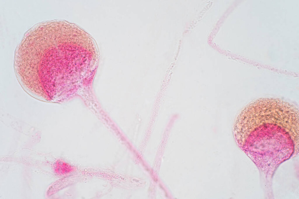 Хліб ризопус формується під мікроскопом. Rhizopus - рід поширених сапрофітичних грибів.. - Фото, зображення