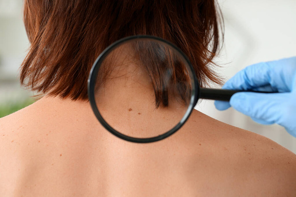 Dermatologist examining patient in clinic - Foto, afbeelding