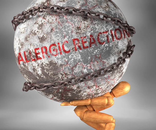 Reacción alérgica y dificultades en la vida - ilustrado por la palabra Reacción alérgica como un peso pesado sobre los hombros para simbolizar la reacción alérgica como una carga, ilustración 3d - Foto, imagen