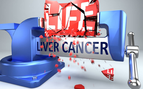 Maksasyöpä voi pilata ja tuhota elämää - symboloi sana maksasyöpä ja pahe näyttää negatiivisen puolen maksasyöpä, 3d kuva - Valokuva, kuva