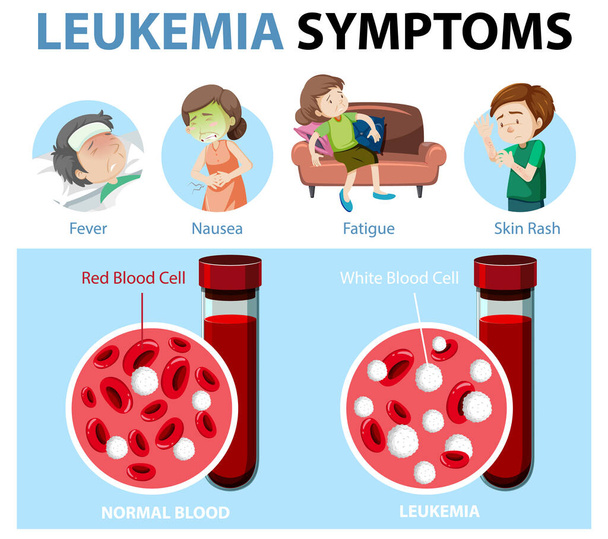 Leucemia sintomi stile cartone animato illustrazione infografica - Vettoriali, immagini