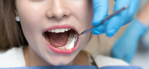 Diş hekimi, hastanın yanaklarına açık ağızdan örnek verir. Diş tedavisi ve bakteri önleme kavramı - Fotoğraf, Görsel