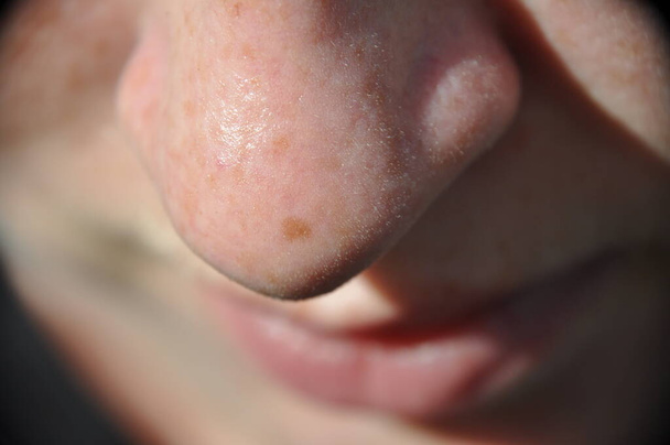 Μακρο closeup μύτη του κοριτσιού γυναίκα με ένα ενιαίο φακίδα και Vellus μαλλιά. - Φωτογραφία, εικόνα