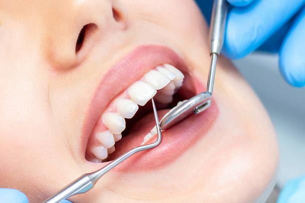 dentist examines the patients teeth at the dentist. close up - Фото, изображение