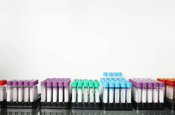 Ιατρικοί δοκιμαστικοί σωλήνες με έγχρωμους κάλυκες για διάφορες εξετάσεις αίματος και άλλων υγρών - Φωτογραφία, εικόνα