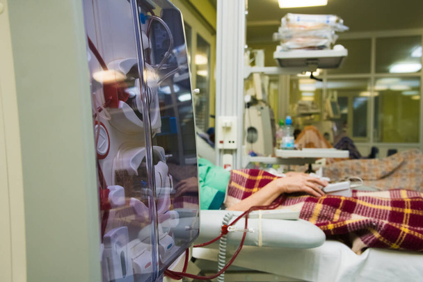 Patient surveillé par sphygmomanomètre électronique pendant la séance de dialyse. Équipement avancé de dialyse à l'hôpital - Photo, image
