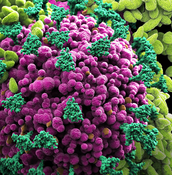 Ιός του κερατοειδούς στο μικροσκόπιο που δέχεται επίθεση από μικροοργανισμούς που προκαλούν ανοσολογική αντίδραση. Εμβόλιο κατά του ιού Covid- 19 coronavirus - Φωτογραφία, εικόνα