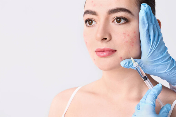 Mujer joven con problemas de acné recibiendo inyección en la cara contra el fondo claro - Foto, Imagen