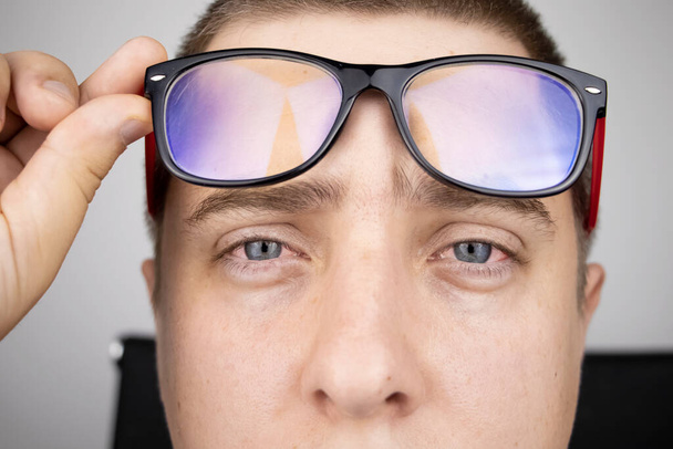Mężczyzna zdejmuje okulary i pokazuje zmęczone czerwone oczy na białym tle. Koncepcja zmęczenia oczu od komputera i zmęczenia pracą. Ból oczu i czoła, migrena, choroby oczu - Zdjęcie, obraz