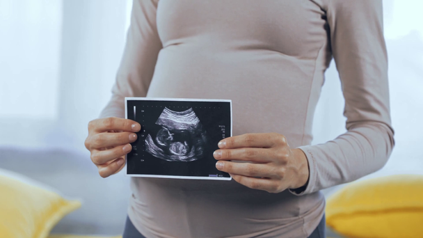 Vista ritagliata della donna incinta che tiene l'ecografia del bambino  - Filmati, video