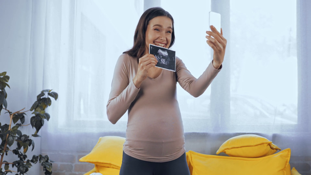 Έγκυος γυναίκα που έχει βιντεοκλήση και κρατώντας υπερηχογράφημα του μωρού  - Πλάνα, βίντεο