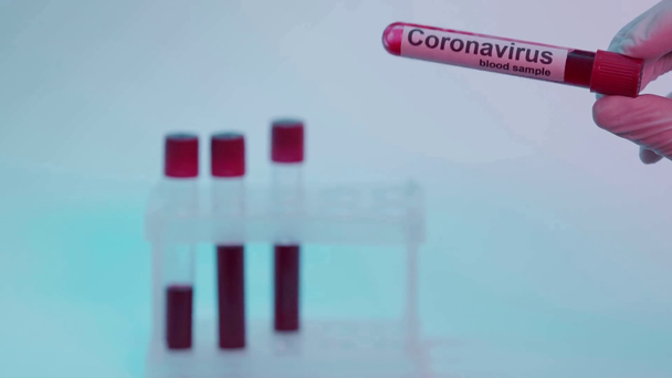 vista ritagliata dello scienziato che tiene la provetta con iscrizione del campione di sangue su blu - Filmati, video