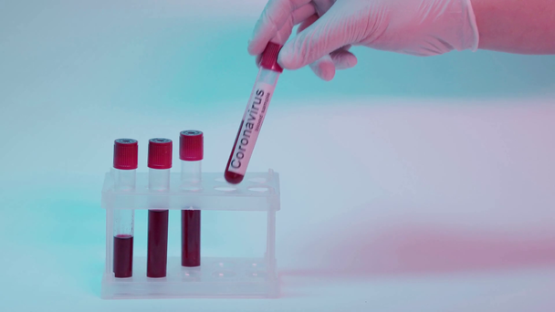 青い上にコロナウイルスの血液サンプルを採取した男のクロップドビュー - 映像、動画