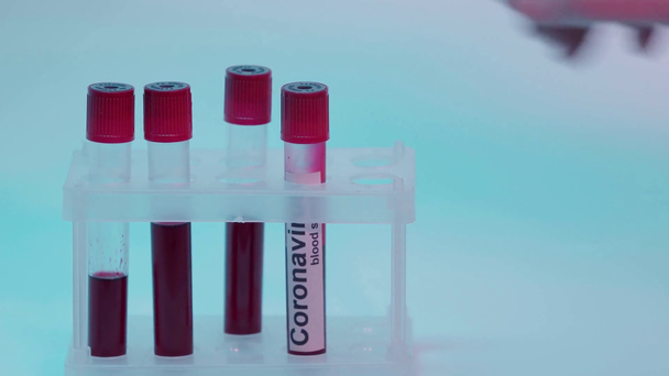 血液サンプルレタリング付き血液検査管を持つ人のラックフォーカス - 映像、動画