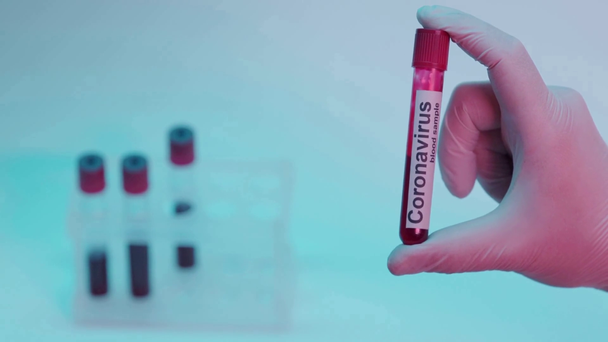 vista recortada de la persona sacudiendo el tubo de ensayo con la inscripción de la muestra de sangre en azul - Imágenes, Vídeo
