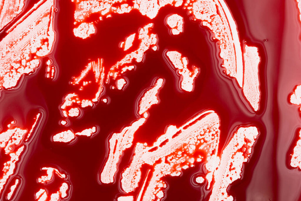 Blutige Spritzer und Tropfen auf weißem Hintergrund. Tropfendes und folgendes rotes Blut (Farbe) - Foto, Bild