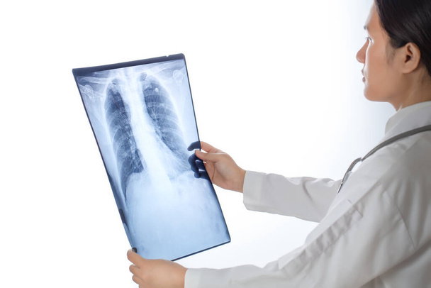 Doctor mirando película de rayos X en el pecho sobre fondo blanco. - Foto, imagen