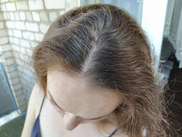 Capelli grigi sulla testa di una donna vicino - Foto, immagini