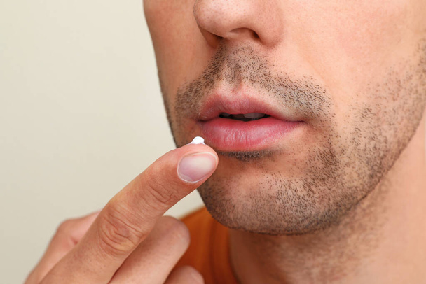 Young man with cold sore applying cream on lips against light background, closeup - Foto, immagini