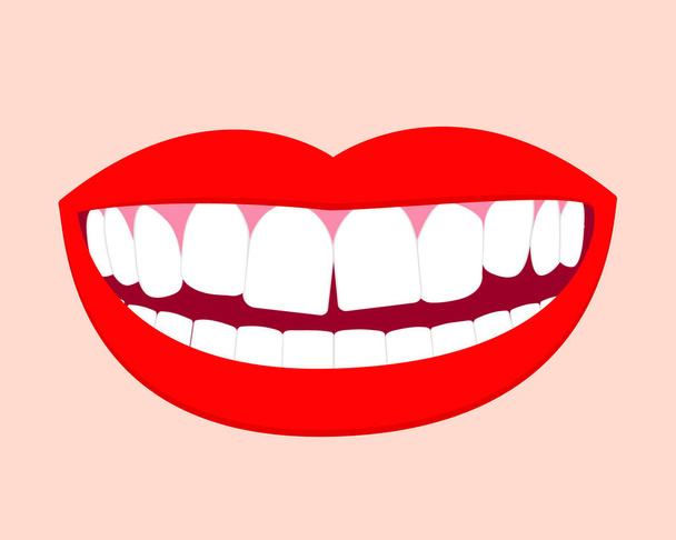 Smile mouth with crooked teeth. Vector isolated elements EPS10 - Vector, Image