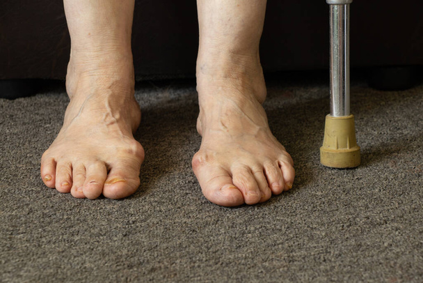 Die Füße der alten Großmutter auf dem Fußboden in ihrem Zimmer in Großaufnahme - Foto, Bild
