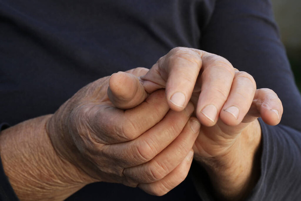 Ältere Frau leidet unter Handschmerzen. Symptome einer Arthritis. - Foto, Bild