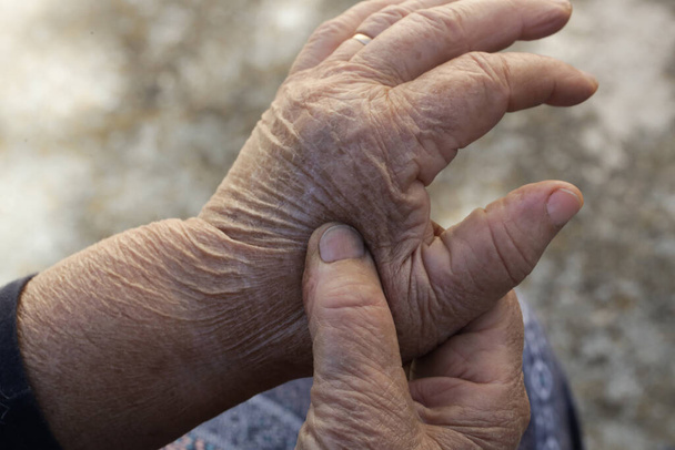 手の痛みに苦しむ高齢女性。関節炎の症状. - 写真・画像