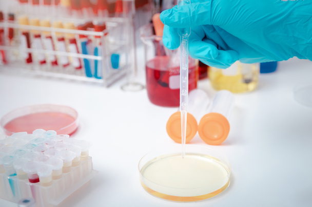 A tudósok petri-csészében vizsgálják az oldatot egy laboratóriumban. Az orvos a kórházi Petri-csészén végzett koronavírus-vizsgálatot vizsgálja.. - Fotó, kép
