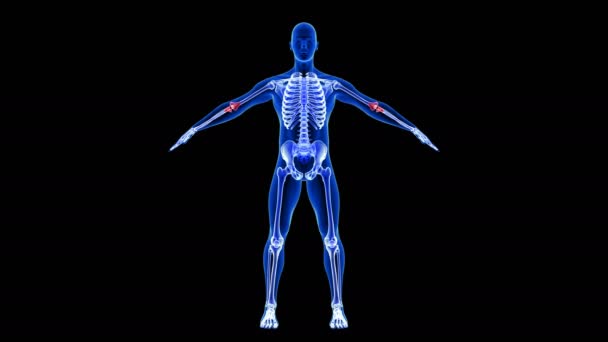 肘の痛み。ブルーヒューマン解剖学ボディ3Dスキャンレンダリング-黒の背景にシームレスなループ - 映像、動画