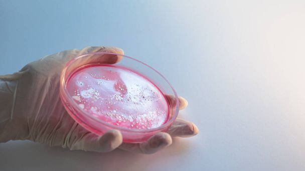 Research of viruses and bacteria, researcher holds a Petri dish with a sample. - Foto, afbeelding