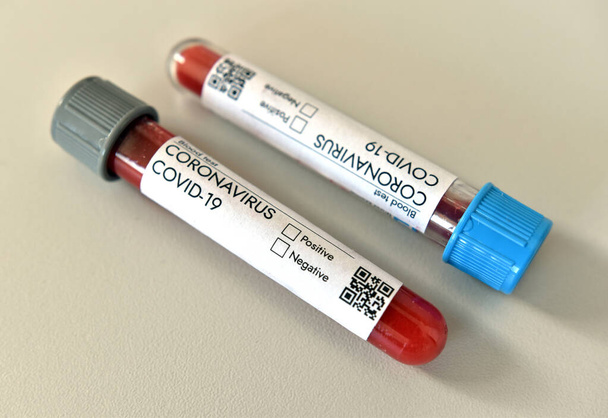 El Coronavirus Covid 19 infectó la muestra de análisis de sangre de resultados positivos en un tubo de investigación en laboratorio donde se prueba la investigación de vacunas en Covid-19. Primer plano sobre fondo blanco. - Foto, Imagen