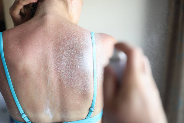 Aerozol ochronny stosuje się na oparzenia słoneczne na plecach kobiet - Zdjęcie, obraz
