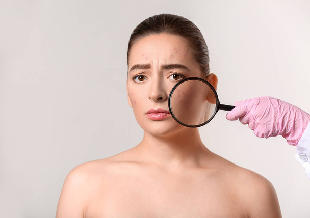 Médico examinando mujer joven con acné problema sobre fondo blanco - Foto, Imagen