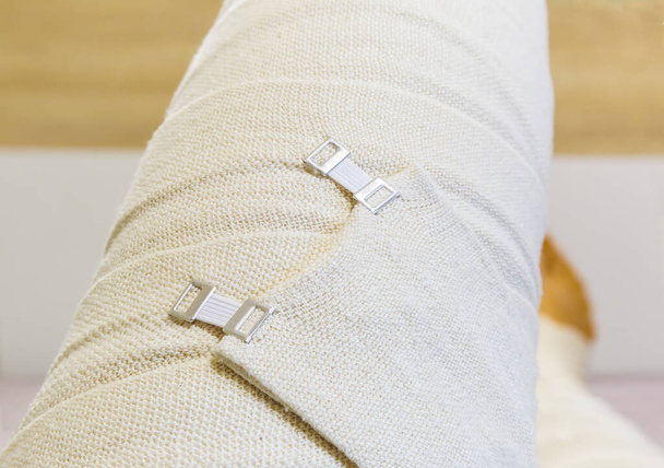 Человеческая нога завернута в тканые эластичные медицинские бинты и закреплена алюминиевыми растягивающимися зажимами на бедре - Фото, изображение