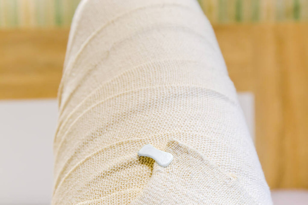 Jambe humaine enveloppée avec un bandage médical élastique tissé et fixée avec un clip en plastique sur une cuisse, gros plan en mise au point sélective - Photo, image