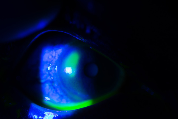 Exame ocular - Foto, Imagem