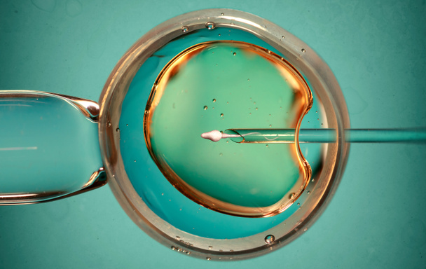 Eizelle mit Nadel und Sperma für künstliche Befruchtung oder In-vitro-Fertilisation. Konzept der künstlichen Befruchtung oder Fruchtbarkeitsbehandlung. Bild - Foto, Bild