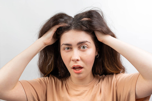 Dandruff, pediculosis and seborrhea. Portrait of a young Caucasian woman, a brunette in a beige t-shirt, who scratches her head with her hand in surprise. White background. - Photo, Image