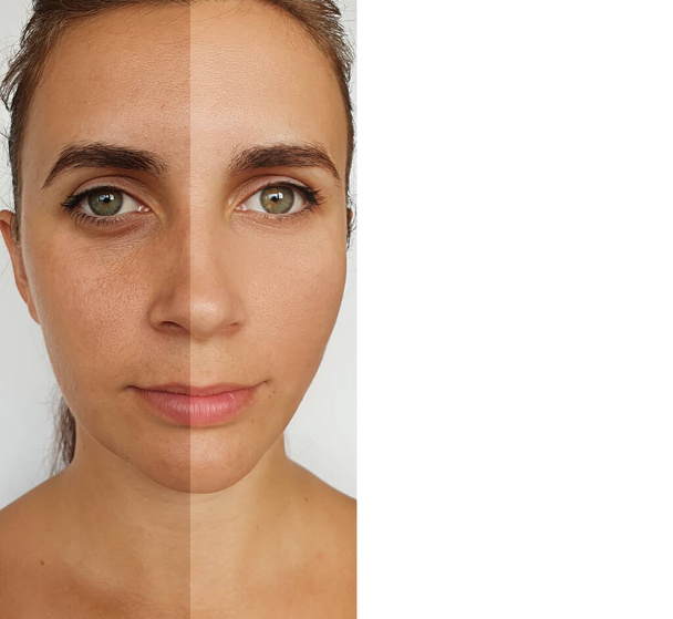 Falten im Gesicht der Frau vor und nach der Behandlung - Foto, Bild
